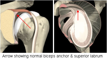 Slap Tear