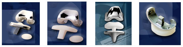 Solved] The contact between femoral and tibia components in knee joint